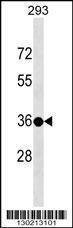 Anti-TSPY3 (C-term) Antibody