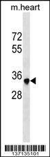 Anti-Mouse Sbk2 (C-term) Antibody