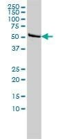Anti-DLD Antibody