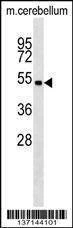 Anti-Mouse Stk11 (C-term) Antibody