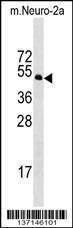 Anti-Mouse Stk39 (C-term) Antibody