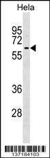 Anti-KLHL12 (C-term) Antibody