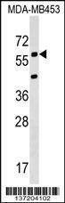 Anti-KCNS3 (N-term) Antibody