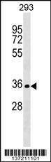 Anti-SIX2 (Center) Antibody