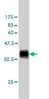 Anti-DLL1 Antibody