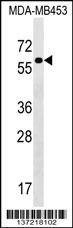 Anti-TRAF3IP3 (N-term) Antibody