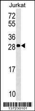 Anti-ANP32C (Center) Antibody