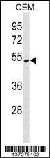 Anti-ONECUT2 (N-term) Antibody