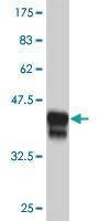 Anti-DLX2 Antibody