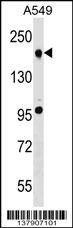 Anti-TET2 (N-term) Antibody