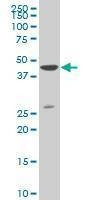 Anti-DLX3 Antibody