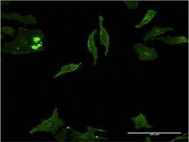 Anti-DLX5 Antibody