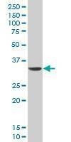 Anti-DLX5 Antibody