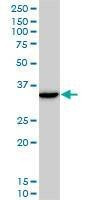 Anti-DLX5 Antibody