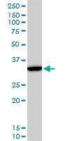Anti-DLX5 Antibody