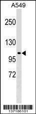 Anti-HECTD3 (C-term) Antibody
