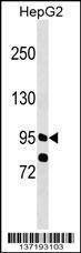 Anti-PPFIBP1 (Center) Antibody