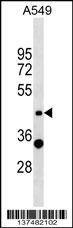 Anti-ZNF19 (N-term) Antibody
