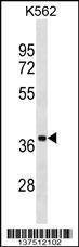 Anti-UBLCP1 (C-term) Antibody