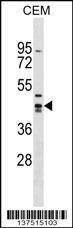 Anti-ZNF193 (Center) Antibody