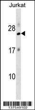 Anti-RPL18 (N-term) Antibody