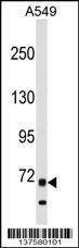Anti-ITK (N-term) Antibody