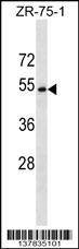 Anti-CCDC112 (N-term) Antibody