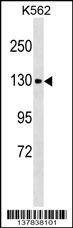 Anti-CHERP (C-term) Antibody