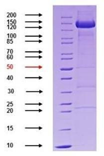 Recombinant SARS-CoV-2 Spike S1-S2 Chimeric Protein