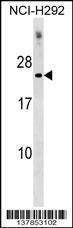 Anti-DNAJC5G (Center) Antibody
