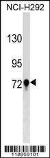 Anti-TGM3 (C-term) Antibody