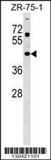 Anti-ZNF323 (Center) Antibody