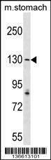 Anti-AGTPBP1 (N-term) Antibody
