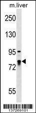 Anti-LARP4 (C-term) Antibody