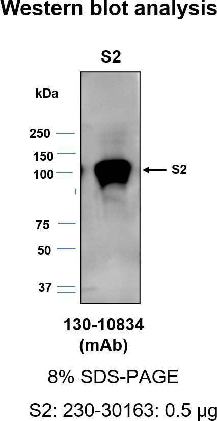 Anti-SARS-COV-2-S2F Antibody