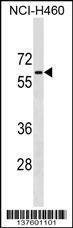 Anti-PGM5 (C-term) Antibody