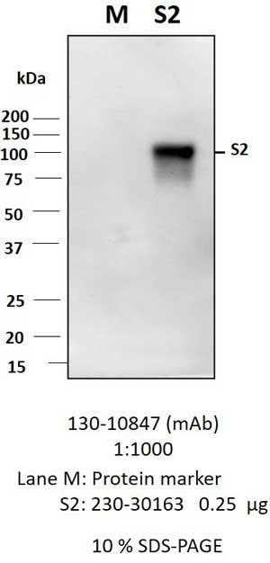 Anti-SARS-CoV-2 S2F Antibody