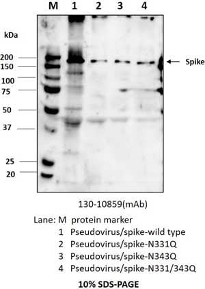 Anti-SARS-CoV-2 S1F Antibody