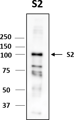 Anti-SARS-CoV-2 S2F Antibody