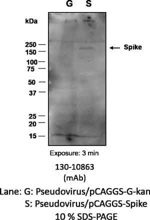 Anti-SARS-CoV-2 S1F Antibody