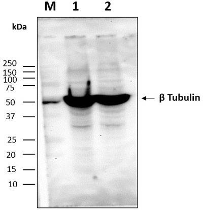Anti-Beta-tubulin (166-183aa) Antibody