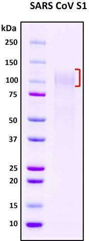 Recombinant SARS-CoV S1 Subunit Protein, full length
