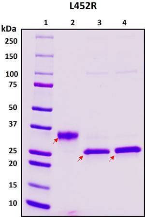 Recombinant SARS-CoV-2 S1 Subunit Protein RBD, L452R mutant