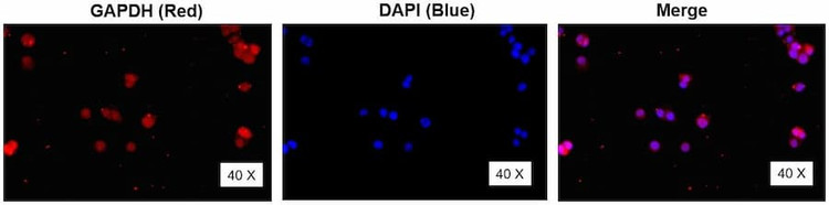 Anti-GAPDH (63~83aa) Antibody