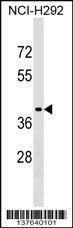 Anti-SNX21 (Center) Antibody