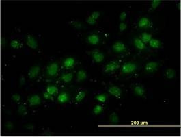 Anti-DNMT2 Antibody