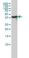 Anti-DNMT2 Antibody