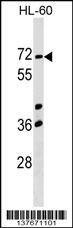 Anti-CCIN (Center) Antibody