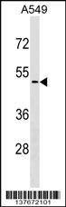 Anti-CDKL4 (C-term) Antibody