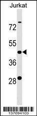 Anti-KCTD9 (Center) Antibody